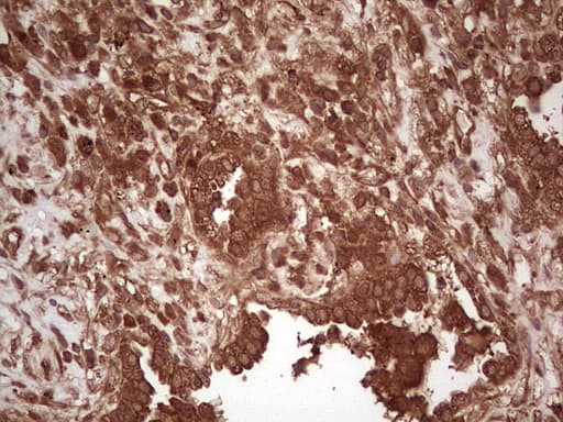 UBE2D2 / UBCH5B Antibody (clone OTI1D11)