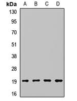 Polyclonal Rabbit anti-Human PPIH / Cyclophilin H Antibody (WB)