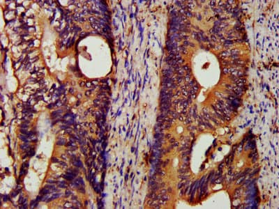 Polyclonal Rabbit anti-Human HSPA5 / GRP78 / BiP Antibody (IHC, WB)