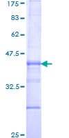 Human ITGB6 / Integrin Beta 6 Protein (Recombinant GST, N-terminus)