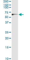 Monoclonal Mouse anti-Human TP53 / p53 Antibody (clone 2C3, IF, WB)