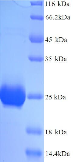 Pig PR / Progesterone Receptor Protein (Recombinant His)