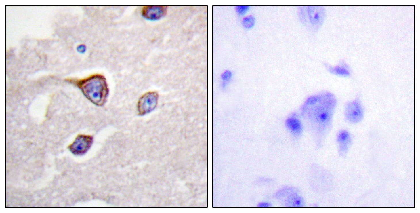 Rhodopsin Kinase / GRK1 Antibody (phospho-Ser21)