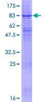 Human RNF128 / GRAIL Protein (Recombinant GST)