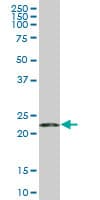 Monoclonal Mouse anti-Human RPS5 / Ribosomal Protein S5 Antibody (clone 3G3, WB)