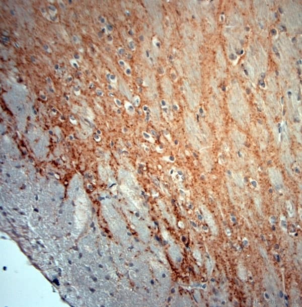 GAD 65+67 Antibody (aa530-600)