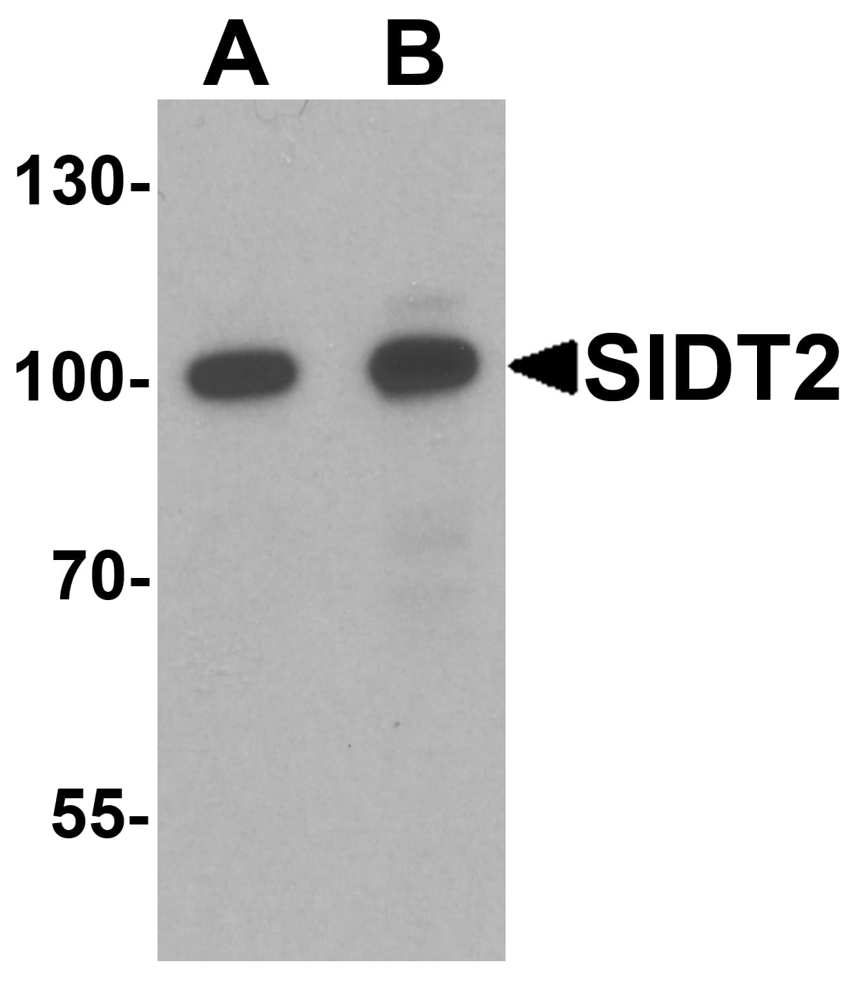IHC-plus™ SIDT2 Antibody