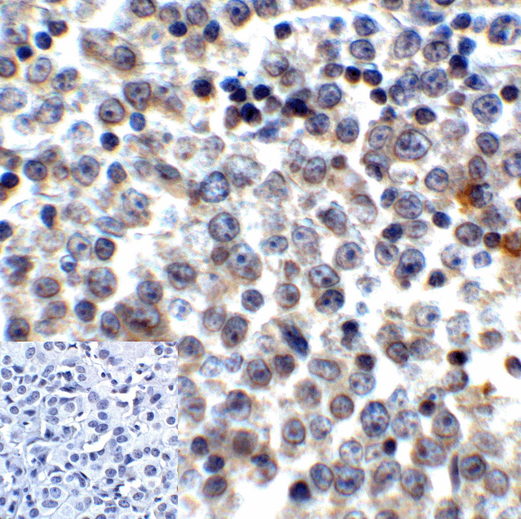 LAG3 Antibody (clone 6D1)