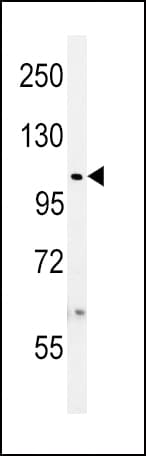 Polyclonal Rabbit anti-Human USP8 / UBPY Antibody (aa1058-1087, IHC, WB)