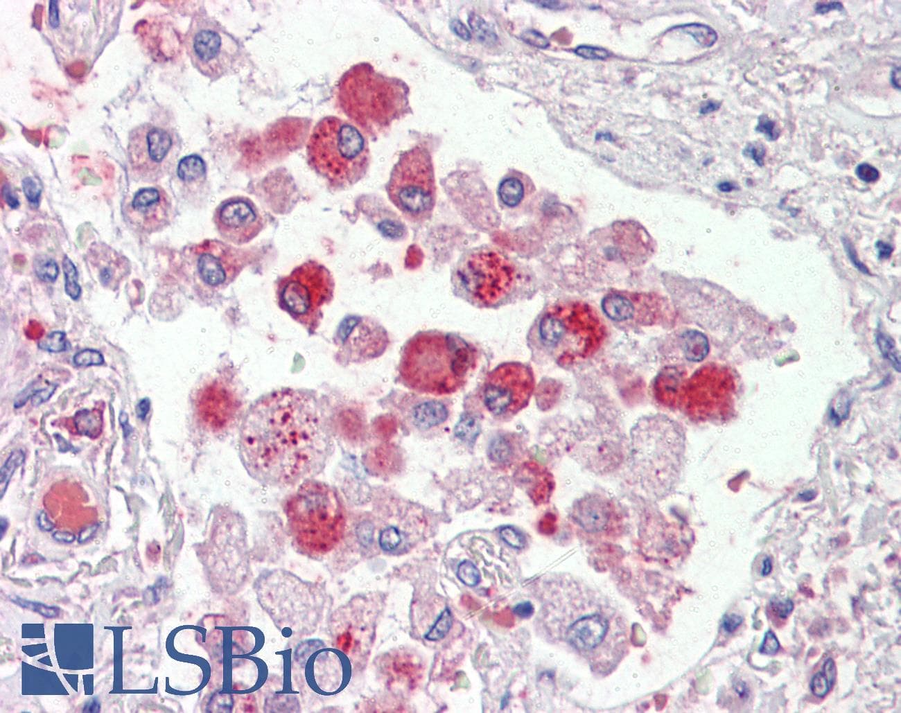 IHC-plus™ Polyclonal Goat anti-Human OSBPL9 Antibody (aa735-746, IHC)