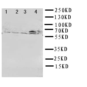 RICK / RIP2 Antibody (aa495-514)