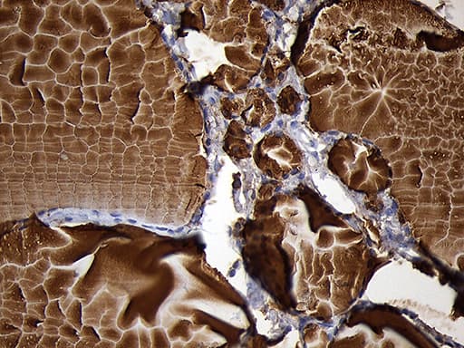 Monoclonal Mouse anti-Human TG / Thyroglobulin Antibody (clone OTI2B9, Carrier-free, aa20-358, IHC)