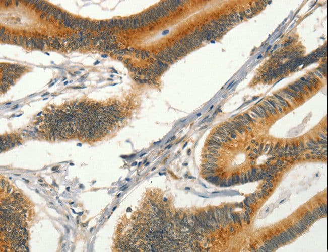 CIB1 / KIP Antibody