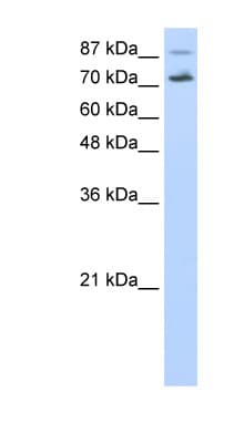 Polyclonal Rabbit anti-Human CDC25B Antibody (aa56-105, IHC, WB)