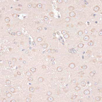 ABCF2 Antibody
