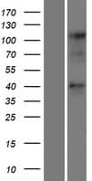 CCRL2 Protein (Over-Expression Lysate Myc-DDK (Flag))