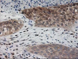 PDXK / PNK Antibody (clone OTI5H5)
