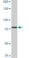 PFKM / PFK-1 Antibody (clone 1D1)