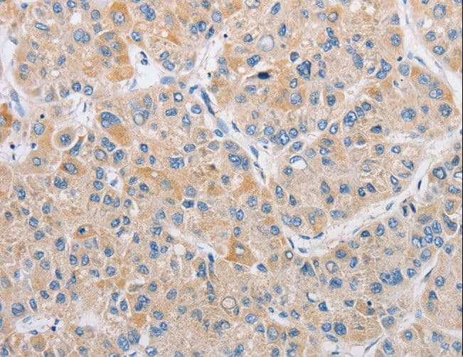 ARHGEF9 / Collybistin Antibody