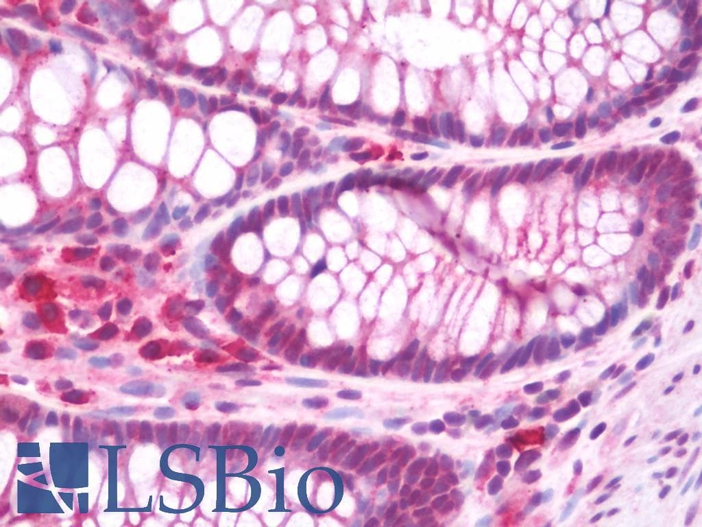IHC-plus™ GSK3A / GSK3 Alpha Antibody (aa448-478)