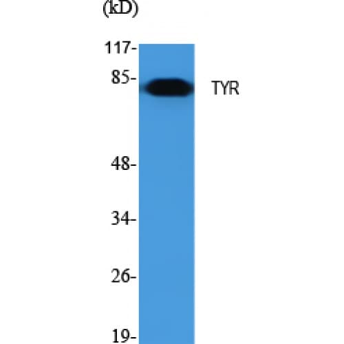 Polyclonal Rabbit anti-Human Tyrosinase Antibody (440-520 aa, C-terminal, WB)