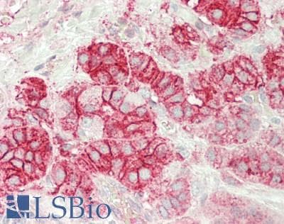IHC-plus™ Polyclonal Rabbit anti-Human KCNJ5 / Kir3.4 / GIRK4 Antibody (C-Terminus, IHC, WB)