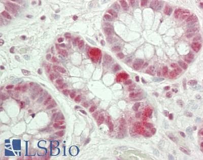 IHC-plus™ Polyclonal Rabbit anti-Human BAF53 / ACTL6A Antibody (aa25-75, IHC, WB)