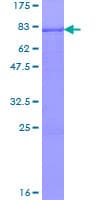 Human TTC8 Protein (Recombinant GST)