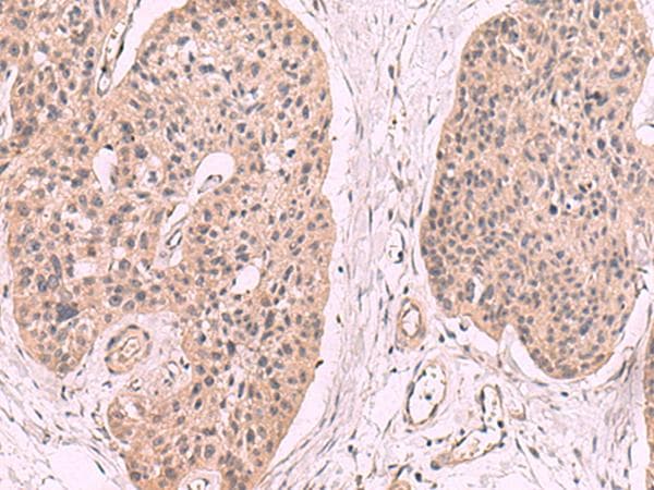 Polyclonal Rabbit anti-Human KLRB1 / CD161 Antibody (IHC, WB)