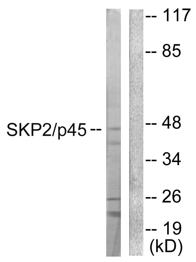 SKP2 Antibody (aa366-415)