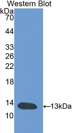 CD118 / LIF Receptor Alpha Antibody (aa382-486, Cy3)