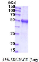 Human UGT1A / UGT1A1 Protein (Recombinant His)