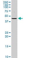 ISLET-1 / ISL1 Antibody (clone 1A3)