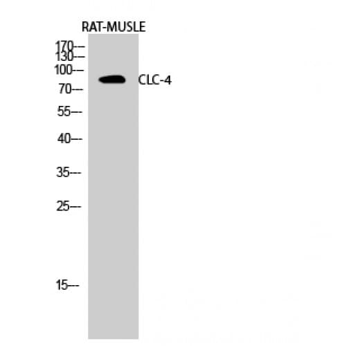 CLCN4 / CLC-4 Antibody (190-270 aa, Internal)
