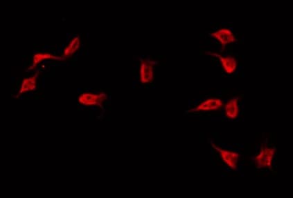 DNAI1 Antibody