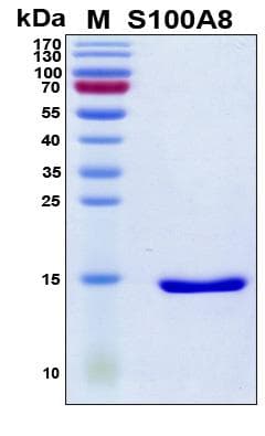 Human S100A8 / MRP8 Protein (Recombinant His, N-Terminal)