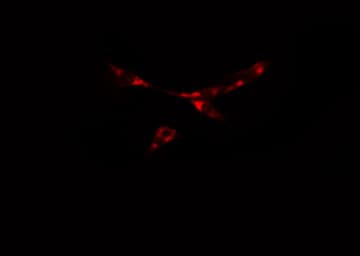 PRKD2 / PKD2 Antibody