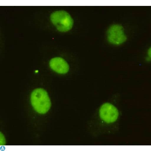 BRINP1 / DBC1 Antibody