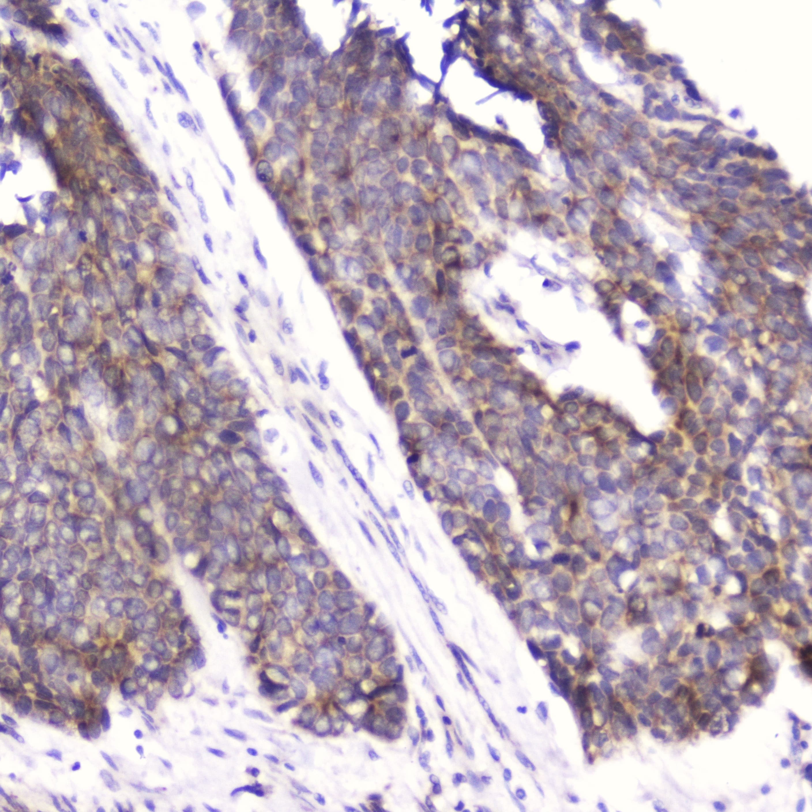 FABP3 / H-FABP Antibody