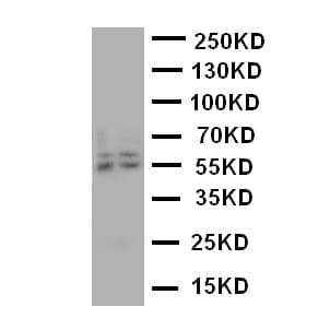 CYP19 / Aromatase Antibody (aa485-503)