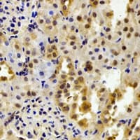 FKBP6 Antibody