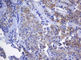 NANP Antibody (clone OTI3C1)