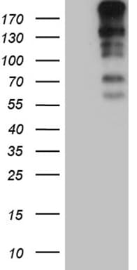 CENPJ / LAP Antibody (aa1087-1338, clone OTI3G8)