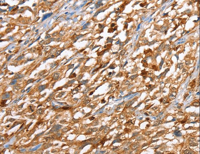 CAPG Antibody