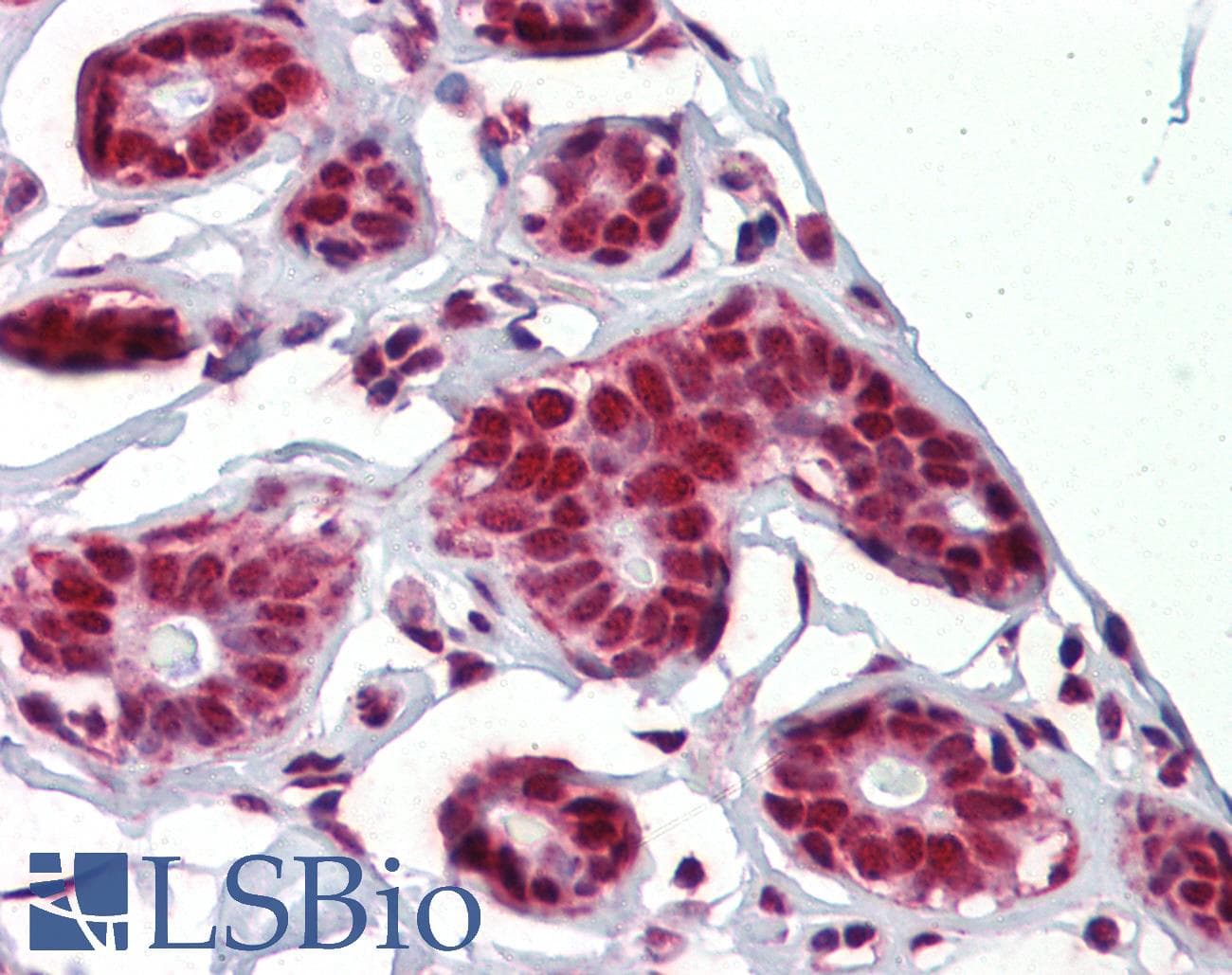 Polyclonal Rabbit anti-Human NKRF / NRF Antibody (C-Terminus, IHC, WB)