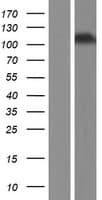 INVS / Inversin Protein (Over-Expression Lysate Myc-DDK (Flag))