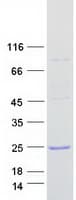 Human CFL2 / Cofilin 2 Protein (Recombinant Myc-DDK (Flag))