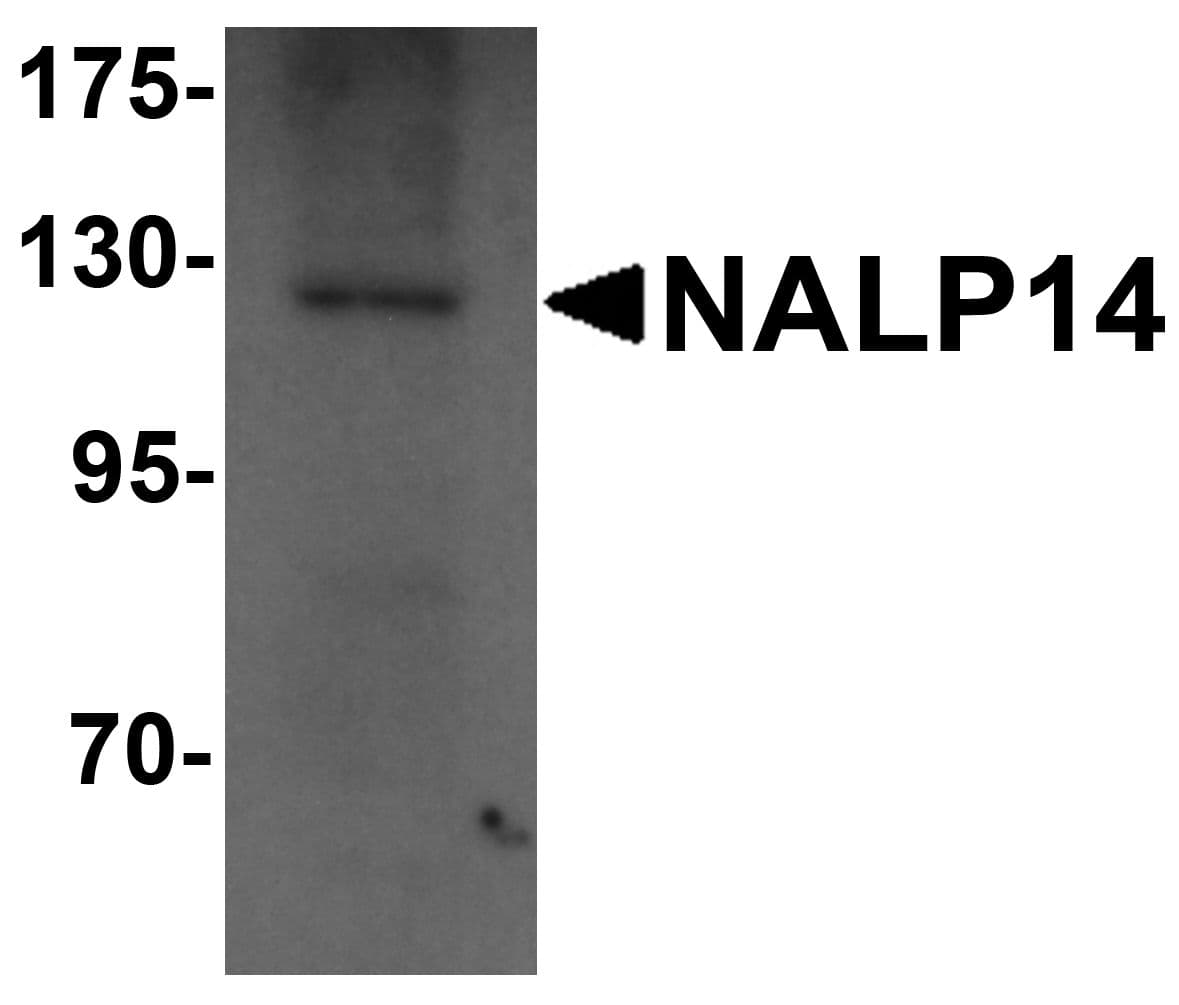 IHC-plus™ Polyclonal Rabbit anti-Human NLRP14 / NALP14 Antibody (IHC, WB)