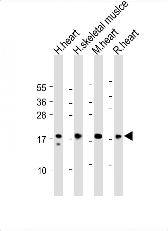 MYL2 Antibody (Internal)
