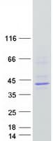 Human MIR16 / GDE1 Protein (Recombinant Myc-DDK (Flag))